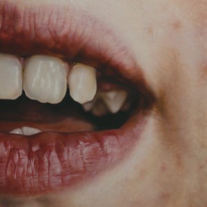 Hyperrealistic oil painting of a child's teeth and lips detail by Jan Petrov, from the Family Re-Construct series.